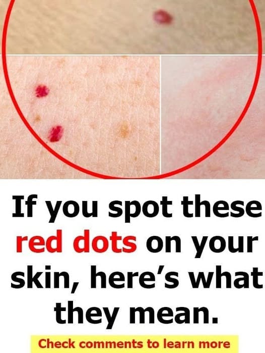 Red Dots on Skin: Common Causes and Their Possible Meanings