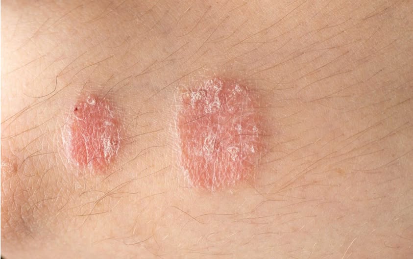 If you observe these signs on your body, seek medical advice without delay.