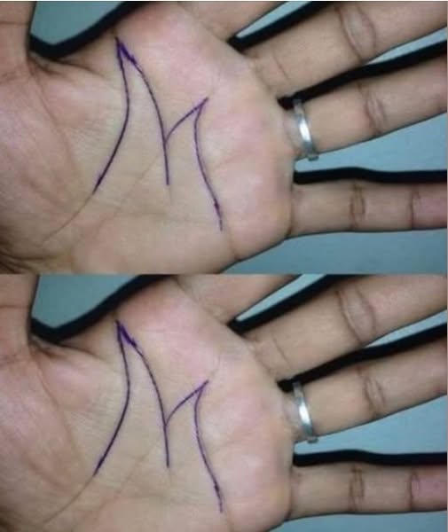 Why Do Some People Have an 'M' on Their Palm?