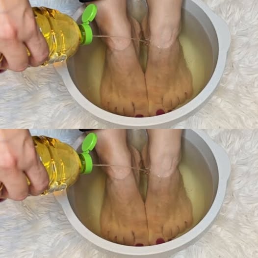 Revolutionize Your Foot Care with Apple Cider Vinegar